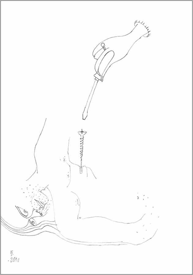 17